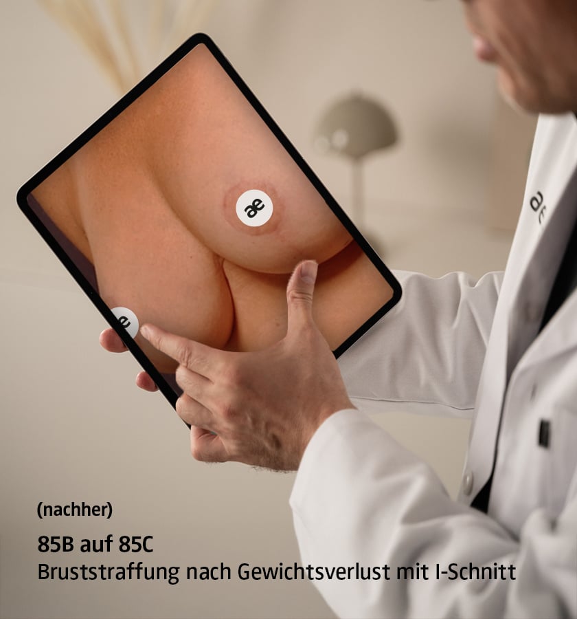 Visualisierung des Nachher-Ergebnisses einer kombinierten Brustvergrößerung mit Implantaten und Bruststraffung auf dem iPad im Gespräch mit Dr. (TU) Ercan Cakmak.