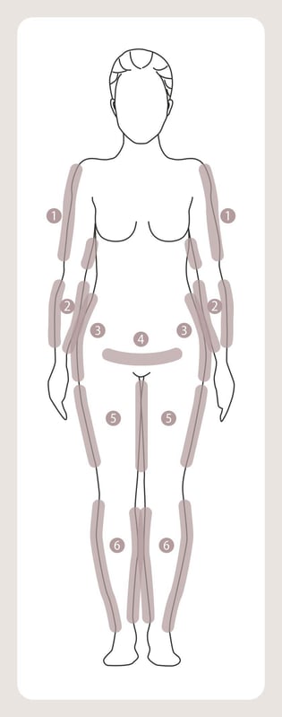Illustration einer weiblichen Silhouette mit markierten Körperbereichen, die typischerweise von einem Lipödem betroffen sein können.